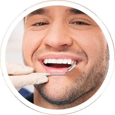 Mazatlan Dental Veneers
