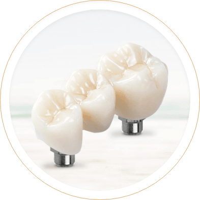 Best Office in Mazatlan for dental crowns