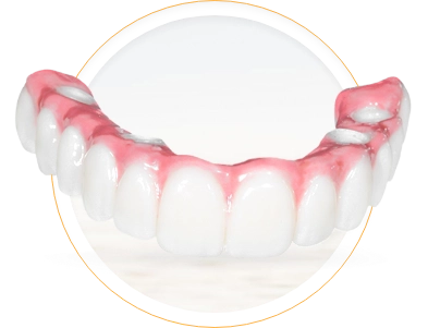 Mazatlan Sinaloa Dental Implants