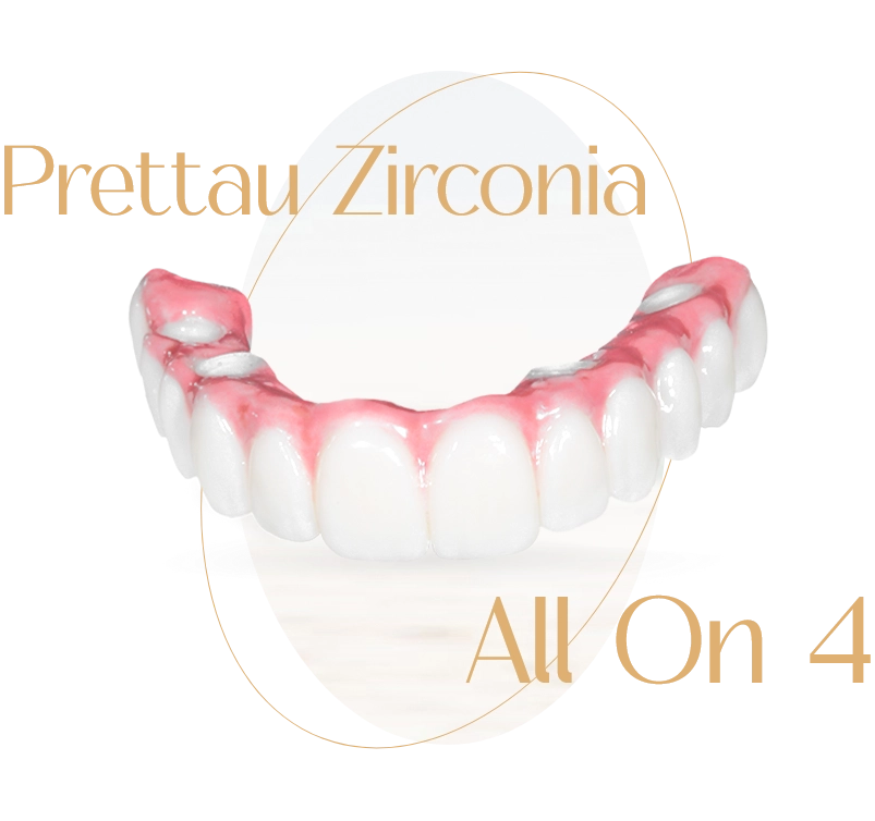 Dental Implants in Mazatlan